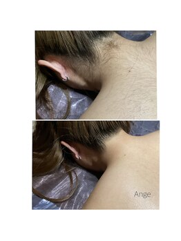 アンジュヴィバラヴィーダ(Ange viva la vida)/脱毛効果無いと諦めないで！