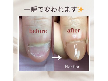 フロールフロール(Flor flor)の写真