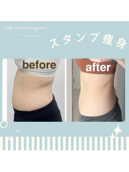 ハロ 南青山(HALO)/スタンプ痩身経過