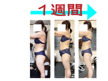 コンフィデンス 谷町四丁目店(Confidence)/1週間２回の変化