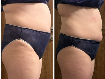 マヨズサロン(Mayo’s salon)/贅沢フルボディーケア