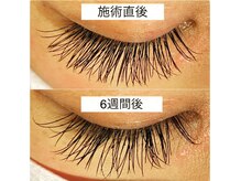 エヌドットアジアン(n.asian)の雰囲気（持続性も重視して施術させていただきます。）