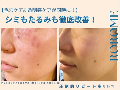 ロロメ(Rorome)の写真