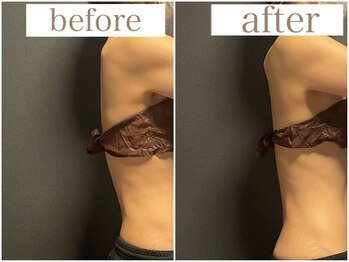 ミミ(MIMI)/【上半身】背中トリートメント