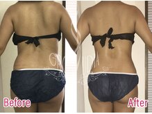 グラウディア 恵比寿/痩身/筋膜リリース/インディバ超