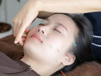 アカリコ鍼灸(Akariko鍼灸)