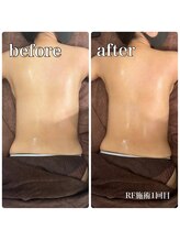 サロンドルクリア(Salon de LUCULIA)/エステ＃ラジオ波脂肪燃焼コース