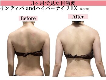 エステサロン ヴリエ 立川店/数字も見た目の変化も重視★