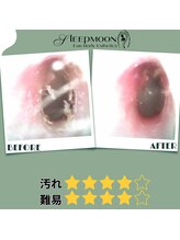 スリープムーン(Sleep MOON)/