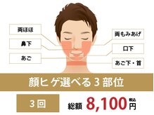 リンクス 栃木宇都宮店(RINX)/ヒゲ脱毛｜まずはお試し体験