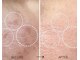ココリラ(cocorira)の写真/初めての方にオススメ◎新規クーポンで毛穴洗浄！ダクトピールでシミ回収し、理想のツヤ肌へ導きます♪