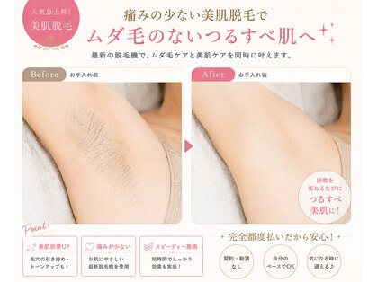 アスピリア(aspirer a')の写真