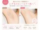 アスピリア(aspirer a')の写真