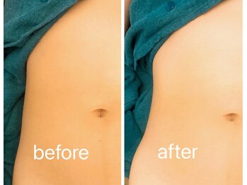 ビューティーサロン リリー(Lily)/