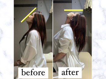 ナオル整体 仙台長町院(NAORU整体)/整体・矯正ビフォーアフター