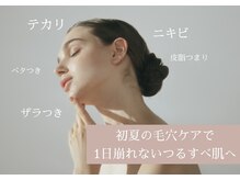 プシュケ(Psyche)