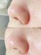 リィプラス(Re+)の写真/毛穴が気になる季節！【眉デザイン＋顔＋毛穴洗浄でツルスベ肌に♪】お化粧ノリUPで顔全体が明るい印象へ◎