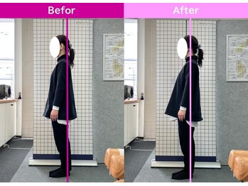 八女整体院/~姿勢改善~首・肩の痛み