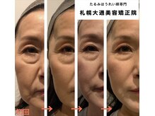札幌大通美容矯正院