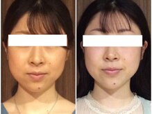 美容整体 ウェリナ 蟹江院/小顔矯正/骨盤矯正/美脚サロン