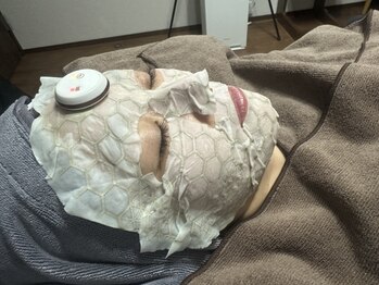 マロン 能町(Marron)の写真/【剥けないハーブピーリングでハリ艶のある水光美肌へ＊】ノーメイクでも自信の持てるお肌へと導きます♪