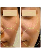 【医療提携】毛穴・たるみ・美肌育成専門店　緒々one＋【チョチョワンプラス】/ホームケアもお任せください