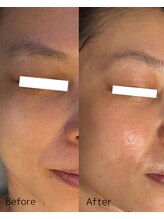 ダイダイ(daidai)/before→after　3回目