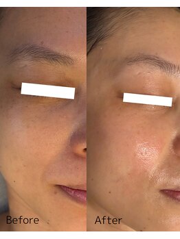 ダイダイ(daidai)/before→after　3回目