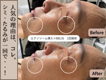 シェリ フルール(Cheri Fleur)の雰囲気（シワ改善たるみケア・ほうれい線には高品質なエクソソーム導入◎）