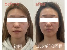 ビーキュート 姫路店(BE-CUTE)/コルギ10回目