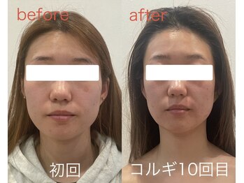 ビーキュート 姫路店(BE-CUTE)/コルギ10回目