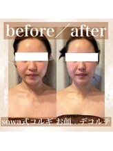 カモミール(chamomile)/BeforeAfter