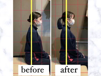 ナオル整体 仙台長町院(NAORU整体)/整体・矯正ビフォーアフター