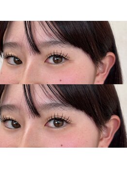 アンリミテッド(Unlimited)/フラットラッシュ付け放題