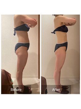 ルナスーリヤ 表参道店/痩身before　after