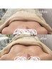 【継続特典★】バストケア光トリートメント　お得な3回コース