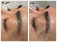 リジョーナ 岐南店(Lijona)/自己処理不要になります