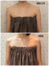 エステティックサロン ベルエトワール住吉店/肩甲骨バストアップマッサージ