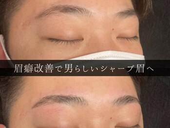 ユー 千葉駅前店(you)/ビフォーアフター写真