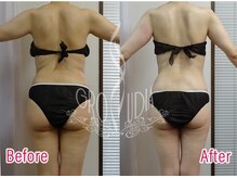 グラウディア 恵比寿/痩身/筋膜リリース/インディバ超