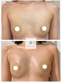 エルミナ.(elmina.)/離れバストにさようなら♪