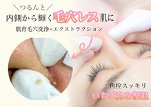 リリーガーデン(Lily Garden)