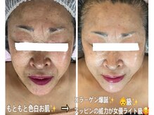 アルページュ(Arpege)/童顔美女♪アイロン級の白雪肌