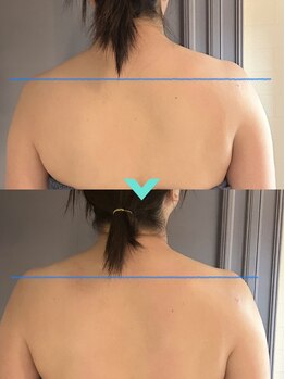 ミルキー(Milky)/体の歪みそのままにしないで