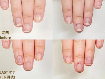 【地爪育成 症例 3】