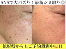 デミーナボーテ(DemynaBeaute)