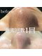 グレイティア(gratia)の写真/頑固な毛穴の黒ずみ皮脂角栓に！最新毛穴クレンジングで、驚くほどクリアなツルツル肌を実感☆