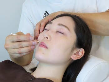 かつらはりきゅう 小児しんの写真/【効果の高い美容鍼】鍼が初めての方にもおススメ。鍼はたくさん刺すのではなく、効果の高いところに厳選。