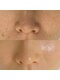 リフロ(Rifuro)の写真/ハリとつやのある水光肌へ！肌管理で毛穴レスな透明感を目指す根本改善サロン☆