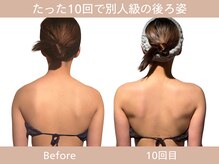 小顔フェイスラボ 栄店(小顔Face Labo.)の雰囲気（整体コルギで肩こり&首コリ解消しながら、猫背・巻き肩も改善◎）